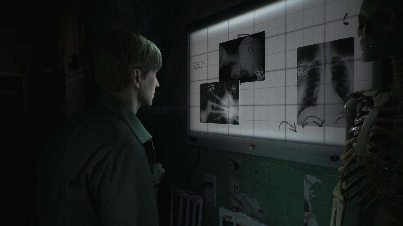 《The Medium》开发商Unreal 5重制《Silent Hill 2》